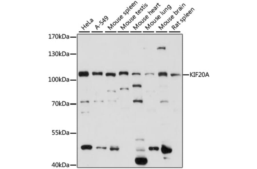 Western Blot - Anti-KIF20A Antibody (A87791) - Antibodies.com