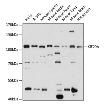 Western Blot - Anti-KIF20A Antibody (A87791) - Antibodies.com