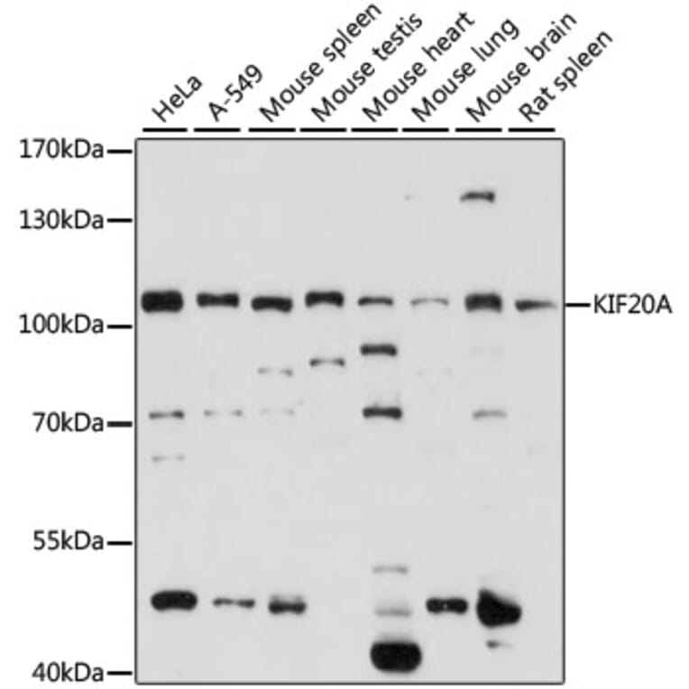 Western Blot - Anti-KIF20A Antibody (A87791) - Antibodies.com