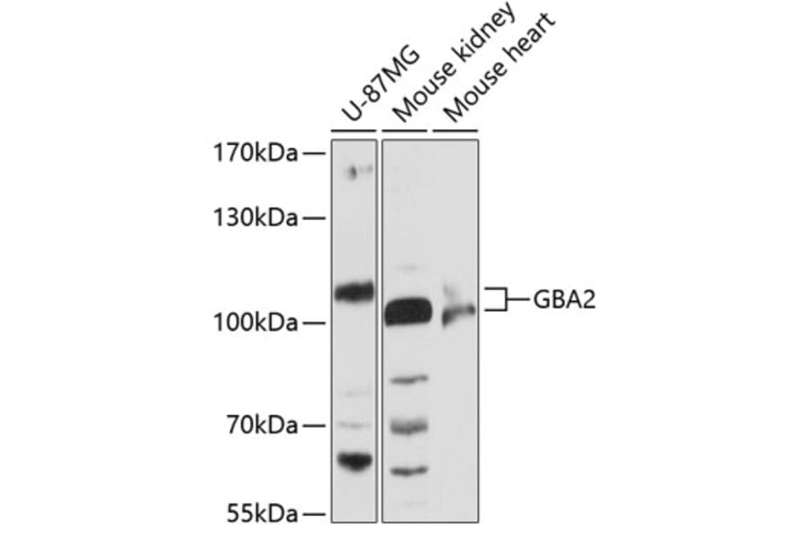 Western Blot - Anti-GBA2 Antibody (A87792) - Antibodies.com