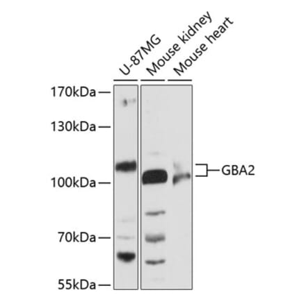 Western Blot - Anti-GBA2 Antibody (A87792) - Antibodies.com