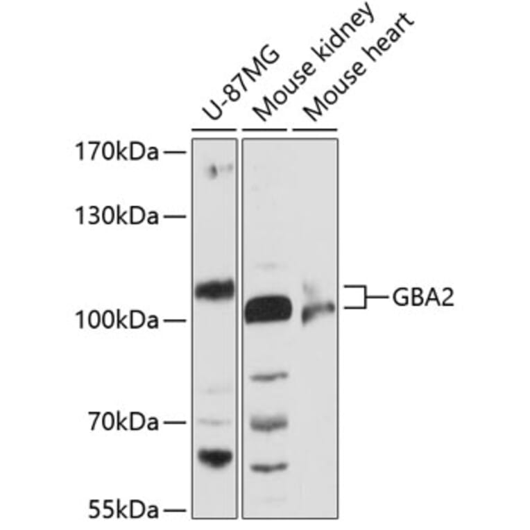 Western Blot - Anti-GBA2 Antibody (A87792) - Antibodies.com