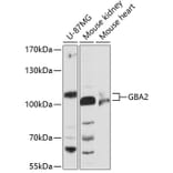 Western Blot - Anti-GBA2 Antibody (A87792) - Antibodies.com