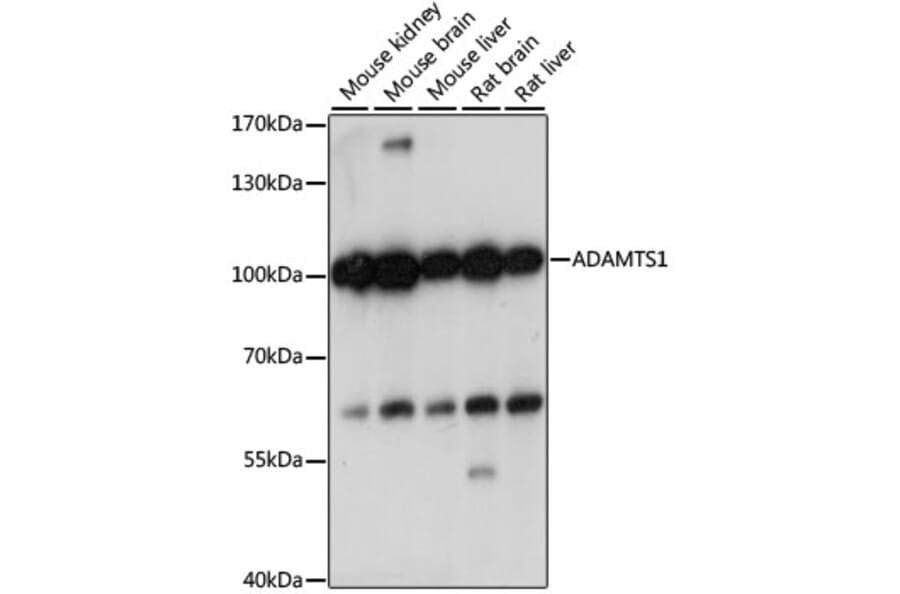 Western Blot - Anti-ADAMTS1 Antibody (A87793) - Antibodies.com