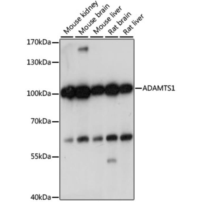 Western Blot - Anti-ADAMTS1 Antibody (A87793) - Antibodies.com