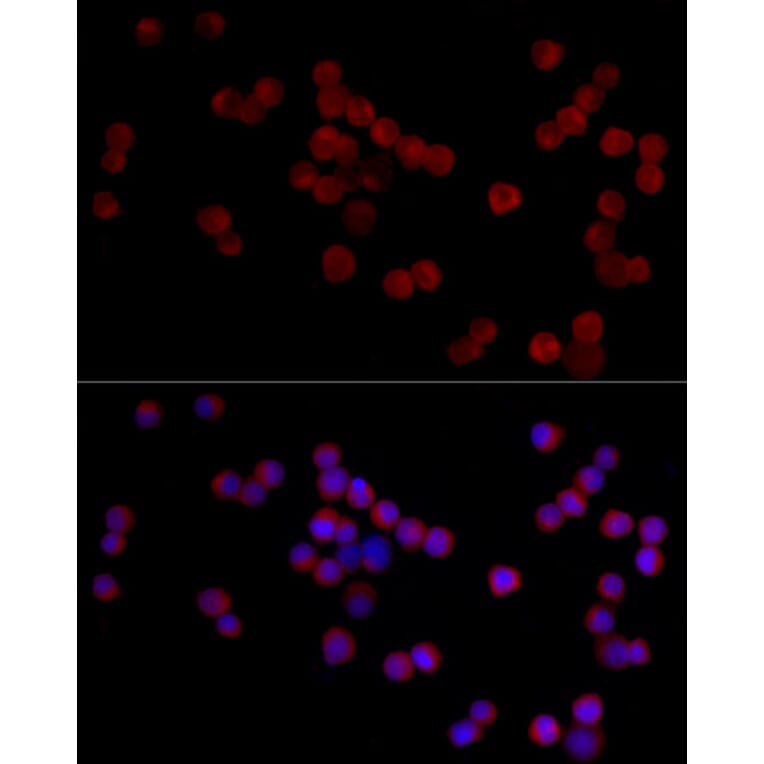 Immunofluorescence - Anti-ADAMTS1 Antibody (A87793) - Antibodies.com