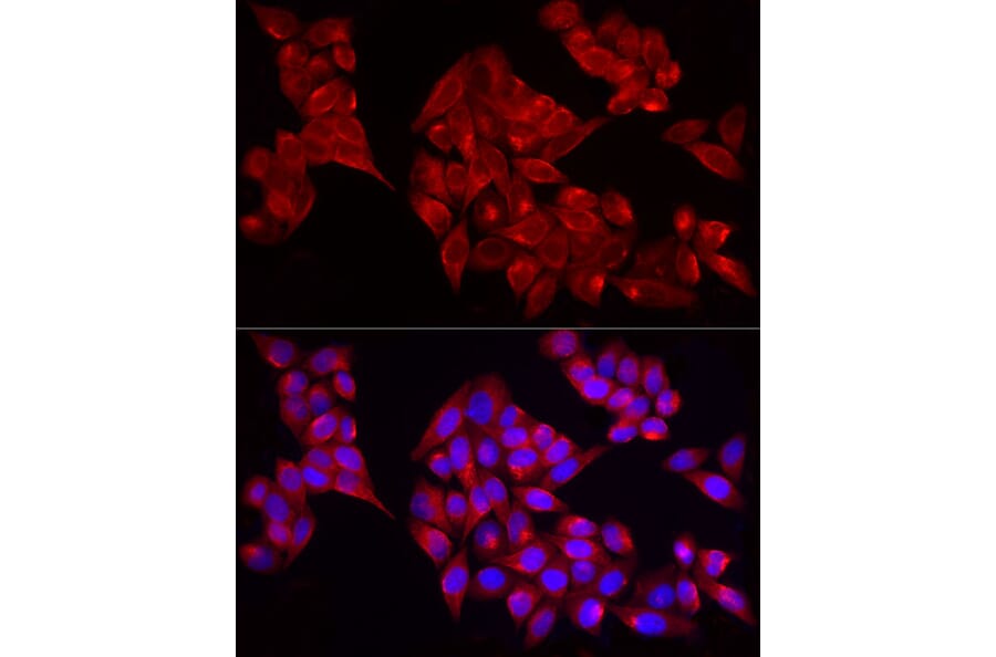 Immunofluorescence - Anti-ADAMTS1 Antibody (A87793) - Antibodies.com