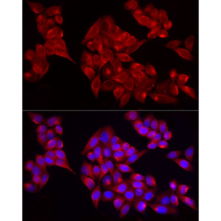 Immunofluorescence - Anti-ADAMTS1 Antibody (A87793) - Antibodies.com