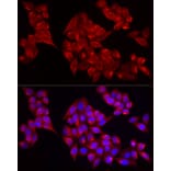 Immunofluorescence - Anti-ADAMTS1 Antibody (A87793) - Antibodies.com