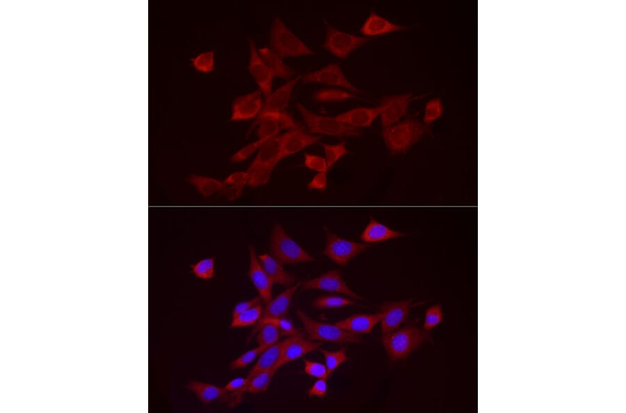 Immunofluorescence - Anti-ADAMTS1 Antibody (A87793) - Antibodies.com