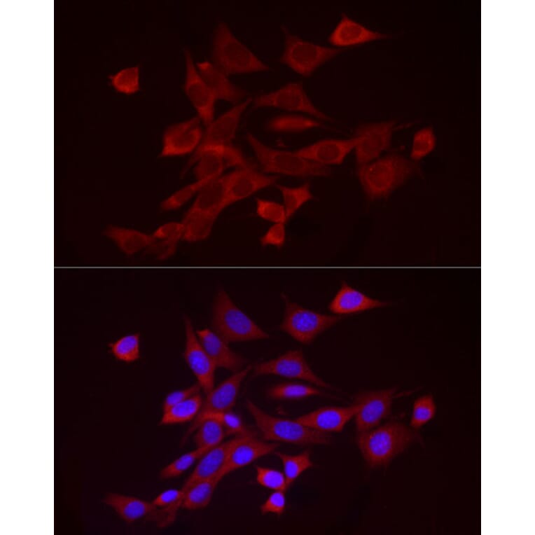 Immunofluorescence - Anti-ADAMTS1 Antibody (A87793) - Antibodies.com