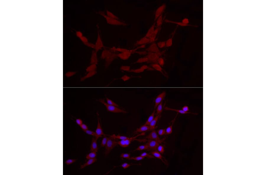 Immunofluorescence - Anti-ADAMTS1 Antibody (A87793) - Antibodies.com