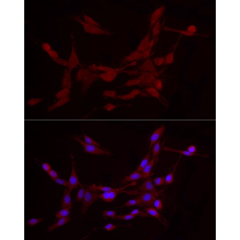 Immunofluorescence - Anti-ADAMTS1 Antibody (A87793) - Antibodies.com