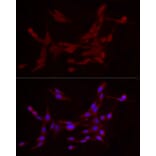 Immunofluorescence - Anti-ADAMTS1 Antibody (A87793) - Antibodies.com