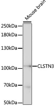 Western blot analysis of extracts of mouse brain, using Anti-CLSTN3 Antibody (A15765) at 1:1,000 dilution.
Secondary antibody: Goat Anti-Rabbit IgG (H+L) (HRP) (AS014) at 1:10,000 dilution.
Lysates / proteins: 25µg per lane.
Blocking buffer: 3% non-fat dry milk in TBST.
Detection: ECL Basic Kit (RM00020).
Exposure time: 30s.