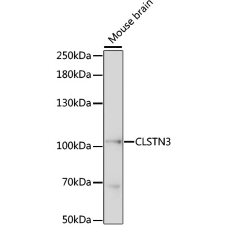 Western Blot - Anti-CLSTN3 Antibody (A87794) - Antibodies.com