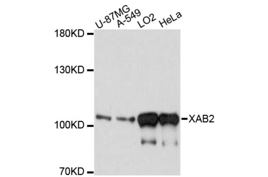 Western Blot - Anti-XAB2 Antibody (A13796) - Antibodies.com