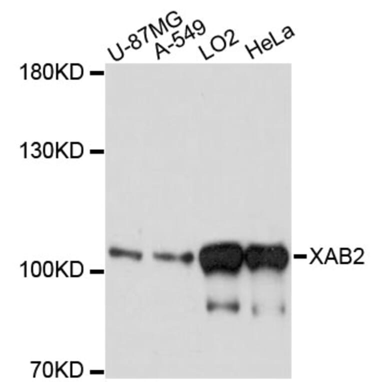 Western Blot - Anti-XAB2 Antibody (A13796) - Antibodies.com