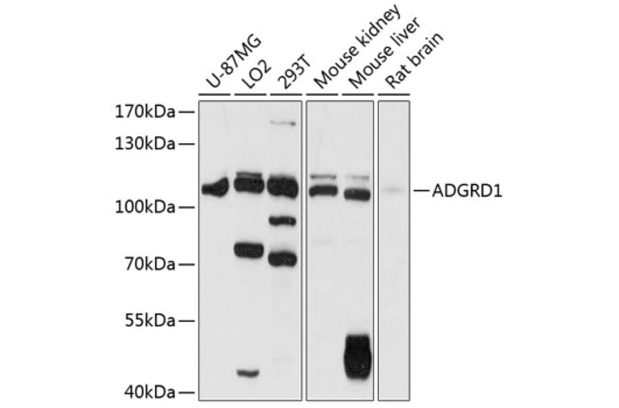 Western Blot - Anti-GPR133 Antibody (A87796) - Antibodies.com