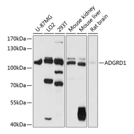 Western Blot - Anti-GPR133 Antibody (A87796) - Antibodies.com