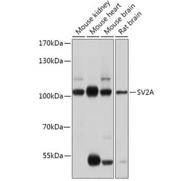 Western Blot - Anti-SV2A Antibody (A87797) - Antibodies.com