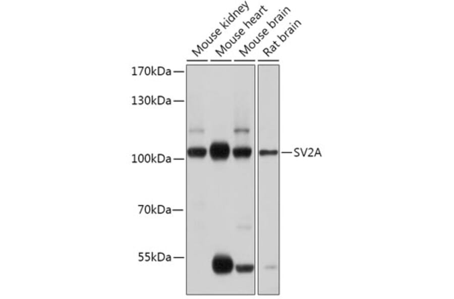 Western Blot - Anti-SV2A Antibody (A87797) - Antibodies.com