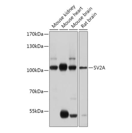 Western Blot - Anti-SV2A Antibody (A87797) - Antibodies.com