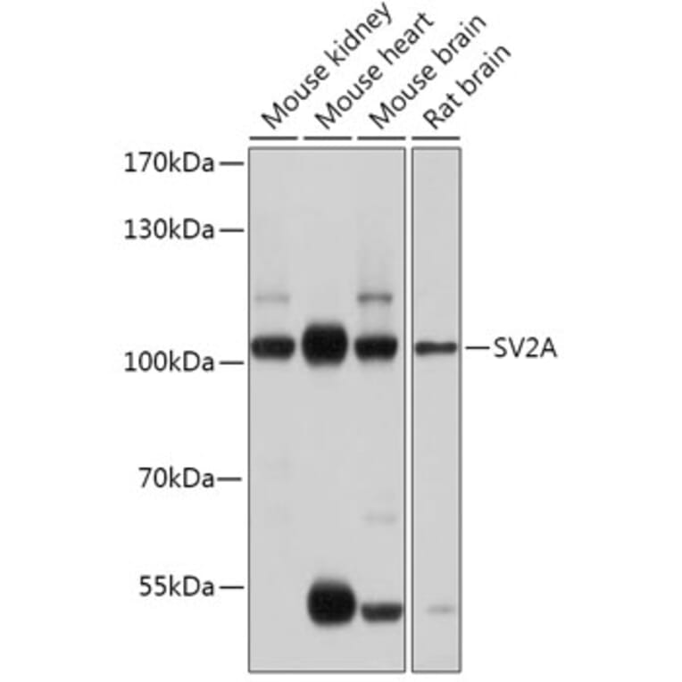 Western Blot - Anti-SV2A Antibody (A87797) - Antibodies.com