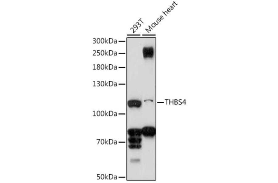 Western Blot - Anti-THBS4 Antibody (A87798) - Antibodies.com