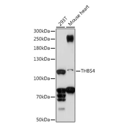 Western Blot - Anti-THBS4 Antibody (A87798) - Antibodies.com