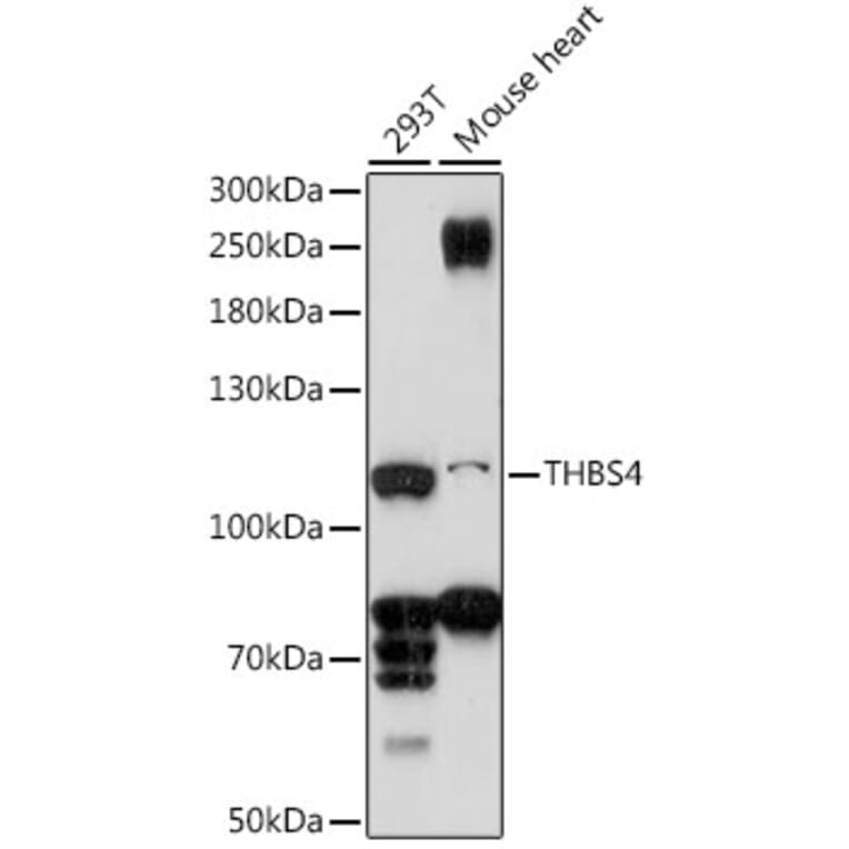 Western Blot - Anti-THBS4 Antibody (A87798) - Antibodies.com