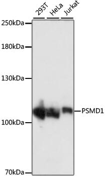 Western blot analysis of extracts of various cell lines, using Anti-PSMD1 Antibody (A16420) at 1:1,000 dilution.
Secondary antibody: Goat Anti-Rabbit IgG (H+L) (HRP) (AS014) at 1:10,000 dilution.
Lysates / proteins: 25µg per lane.
Blocking buffer: 3% non-fat dry milk in TBST.
Detection: ECL Basic Kit (RM00020).
Exposure time: 1s.