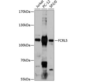 Western Blot - Anti-FCRL5 Antibody (A87800) - Antibodies.com