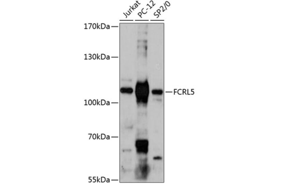 Western Blot - Anti-FCRL5 Antibody (A87800) - Antibodies.com