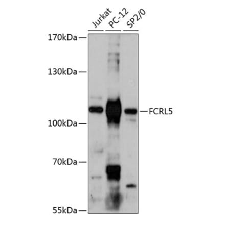 Western Blot - Anti-FCRL5 Antibody (A87800) - Antibodies.com