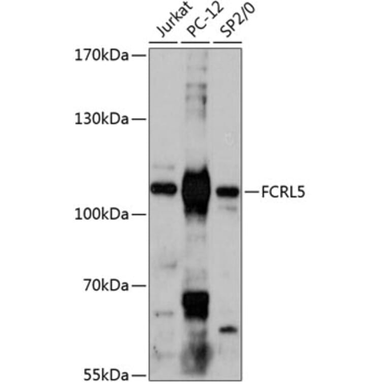 Western Blot - Anti-FCRL5 Antibody (A87800) - Antibodies.com