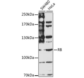 Western Blot - Anti-Rb Antibody (A87801) - Antibodies.com