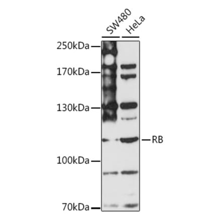 Western Blot - Anti-Rb Antibody (A87801) - Antibodies.com