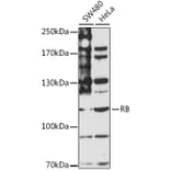 Western Blot - Anti-Rb Antibody (A87801) - Antibodies.com