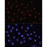 Immunofluorescence - Anti-Rb Antibody (A87801) - Antibodies.com