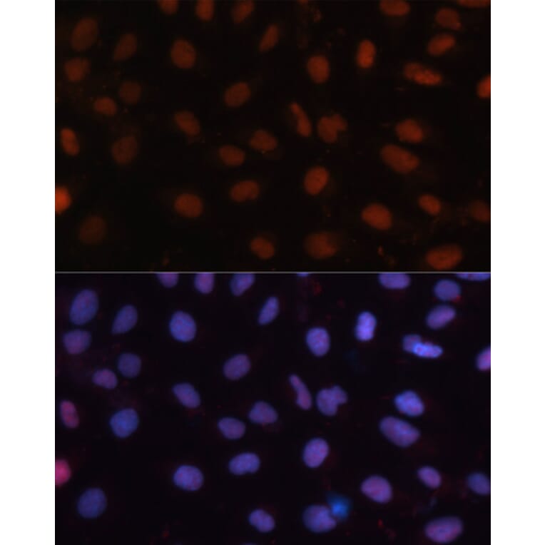 Immunofluorescence - Anti-Rb Antibody (A87801) - Antibodies.com