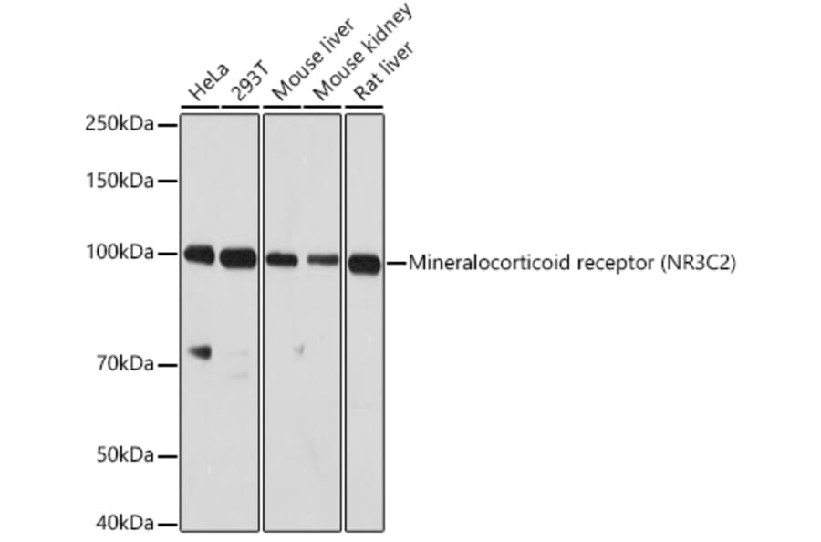 Western Blot - Anti-Mineralocorticoid Receptor Antibody (A87802) - Antibodies.com