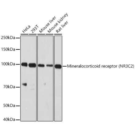 Western Blot - Anti-Mineralocorticoid Receptor Antibody (A87802) - Antibodies.com
