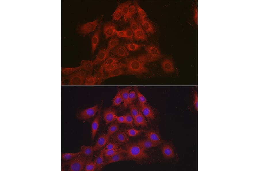 Immunofluorescence - Anti-Mineralocorticoid Receptor Antibody (A87802) - Antibodies.com