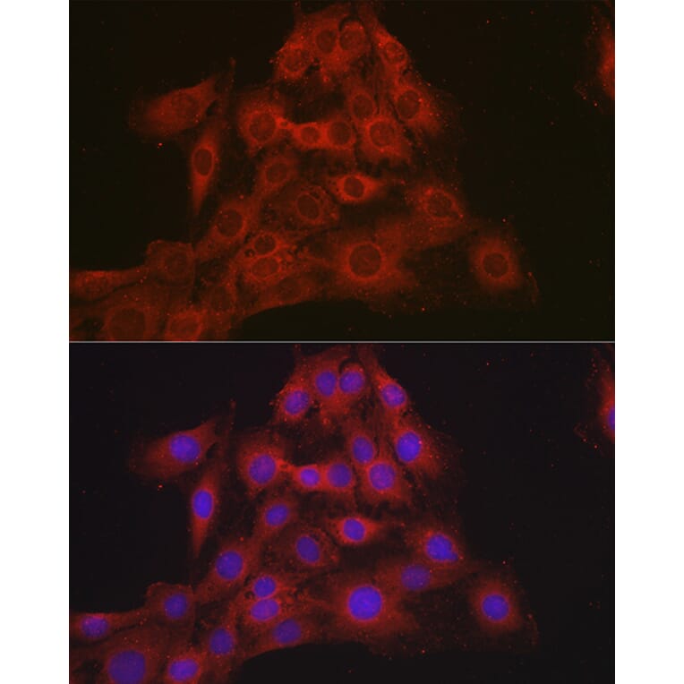Immunofluorescence - Anti-Mineralocorticoid Receptor Antibody (A87802) - Antibodies.com