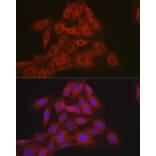 Immunofluorescence - Anti-Mineralocorticoid Receptor Antibody (A87802) - Antibodies.com