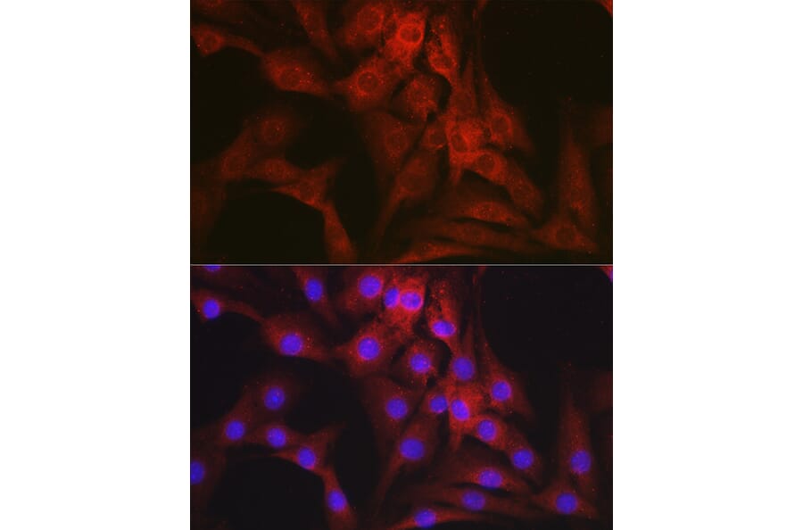 Immunofluorescence - Anti-Mineralocorticoid Receptor Antibody (A87802) - Antibodies.com