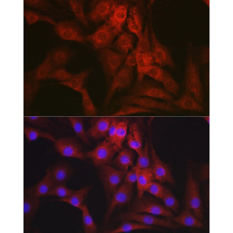 Immunofluorescence - Anti-Mineralocorticoid Receptor Antibody (A87802) - Antibodies.com