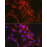 Immunofluorescence - Anti-Mineralocorticoid Receptor Antibody (A87802) - Antibodies.com
