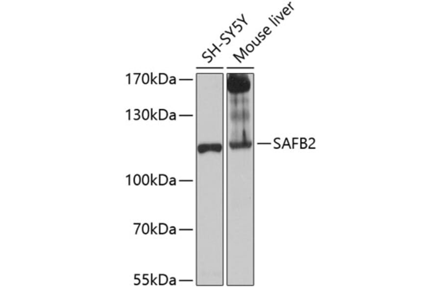 Western Blot - Anti-SAFB2 Antibody (A12550) - Antibodies.com
